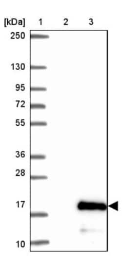 C2orf88 Antibody, Novus Biologicals 0.1mL; Unlabeled:Antibodies, Polyclonal